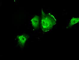 Monoclonal Mouse anti-Human PIM2 / Pim-2 Antibody (clone OTI8B4, IHC, IF, WB)