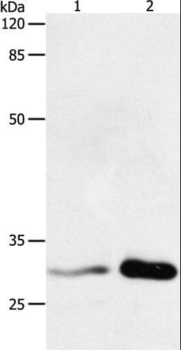 Polyclonal Rabbit anti-Human YWHAB / 14-3-3 Beta Antibody (WB)