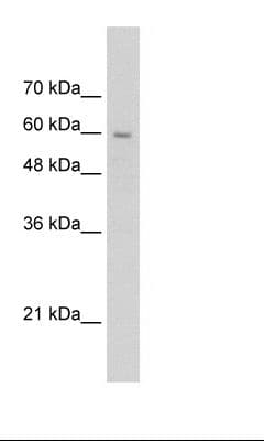 SLC22A1 Antibody (aa100-149, Biotin)