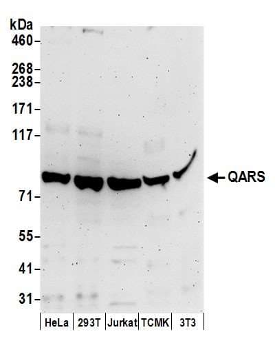 GLNRS / QARS Antibody (aa725-775)