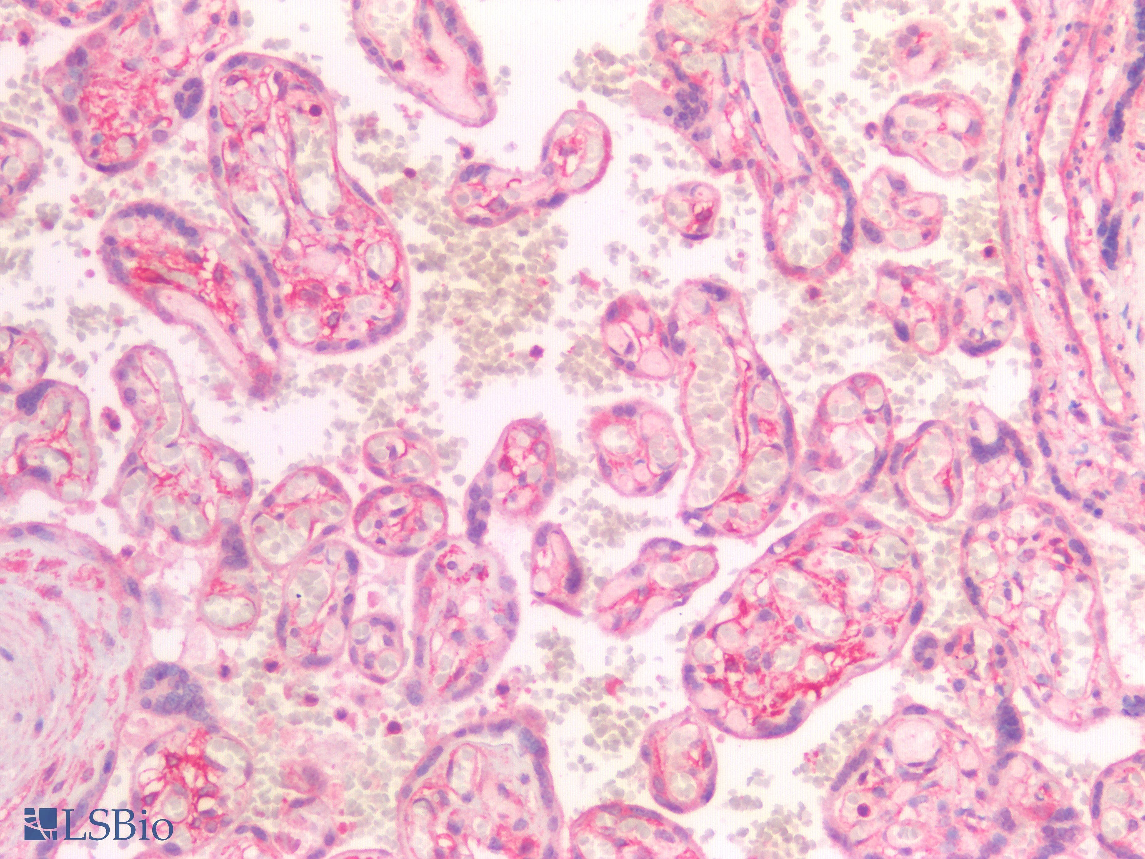 PathPlus™ Polyclonal Rabbit anti-Human SDC1 / Syndecan 1 / CD138 Antibody (IHC)