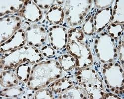 TUBA8 / Tubulin Alpha 8 Antibody (clone OTI2E9)