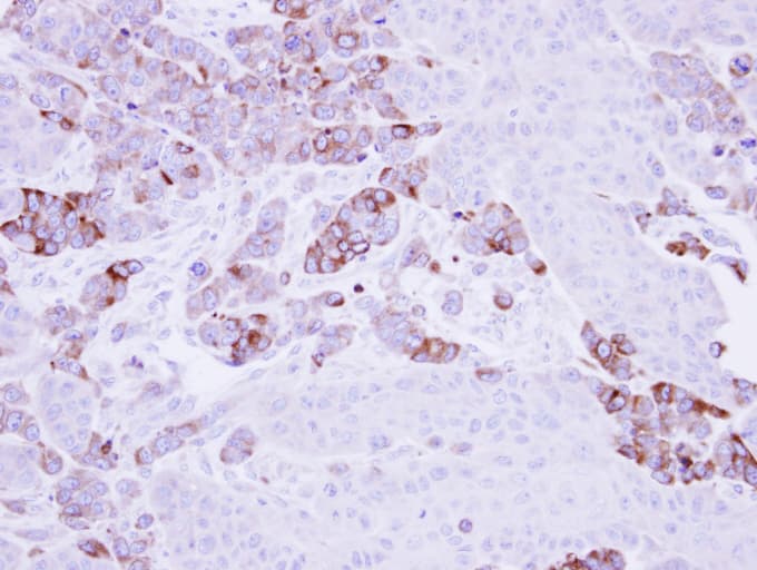 EPHX1 / Epoxide Hydrolase 1 Antibody (aa1-223)