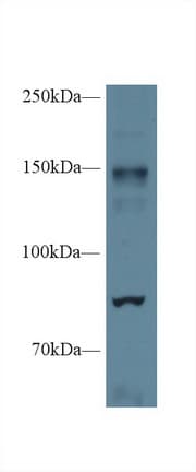 NOS2 / iNOS Antibody (aa43-213)