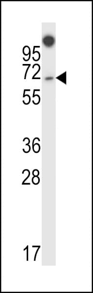 Polyclonal Rabbit anti-Human NUMBLIKE / NUMBL Antibody (aa572-600, IHC, WB)