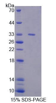 Mouse GBP1 Protein (Recombinant His, N-Terminal)