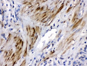 CFL2 / Cofilin 2 Antibody
