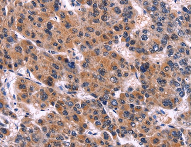 GCN2 Antibody