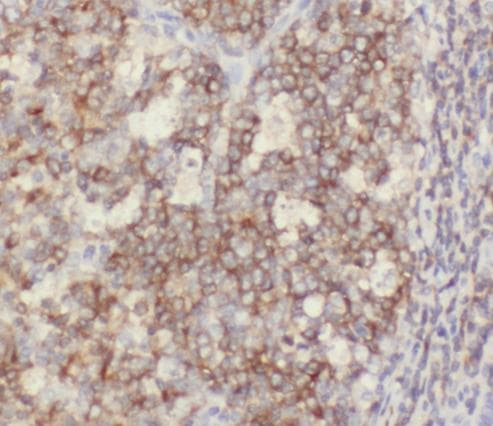 CD6 Antibody