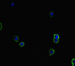 Polyclonal Rabbit anti-Human TIAM1 Antibody (IHC, IF)