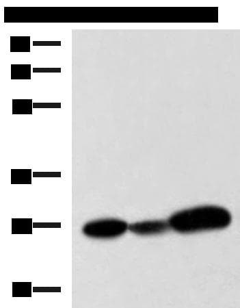 Polyclonal Rabbit anti-Human VEGFA / VEGF Antibody (IHC, WB)