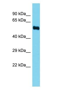 FADS3 Antibody (aa51-100)