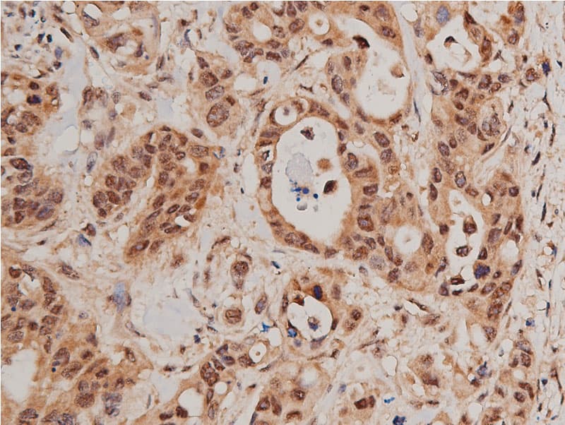 FOXO1 / FKHR Antibody (phospho-Ser319)