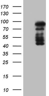 HDAC9 Antibody (aa181-460, clone OTI7G2, Carrier-free)