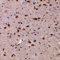 MTDH / Metadherin Antibody