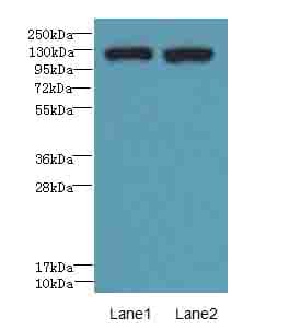 ITGAL / CD11a Antibody