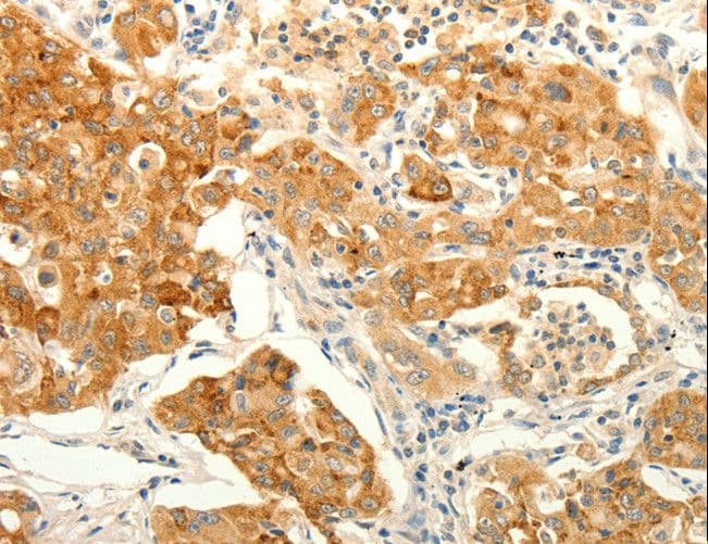 ERG Antibody