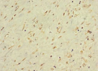 LONRF1 Antibody