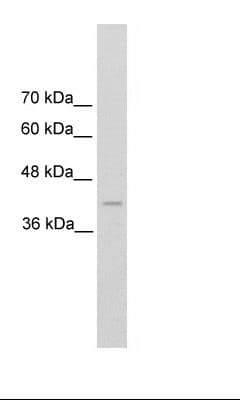 REN / Renin 1 Antibody (C-Terminus)