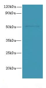 Polyclonal Rabbit anti-Human SNX6 Antibody (IHC, WB)