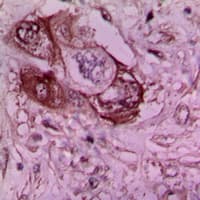 LAMC1 / Laminin Gamma 1 Antibody (C-Terminus)