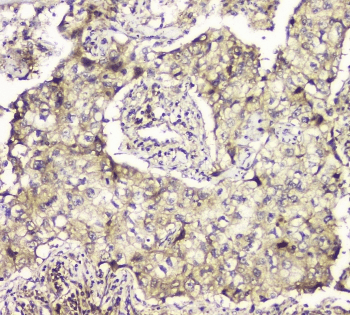 Polyclonal Rabbit anti-Human MCUR1 / CCDC90A Antibody (IHC, WB)