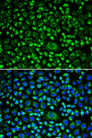 TAPBP / Tapasin Antibody