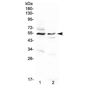 Polyclonal Rabbit anti-Human VIPR1 Antibody (WB)