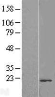 TMUB2 Protein (Over-Expression Lysate Myc-DDK (Flag))