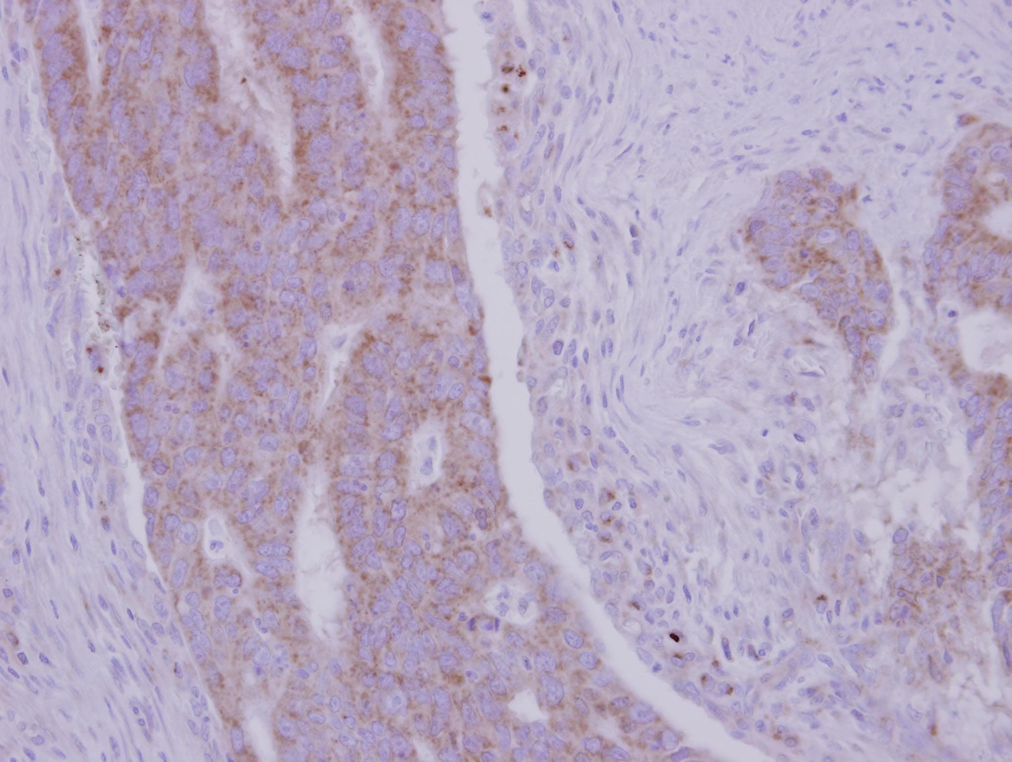 R1 / RRM1 Antibody