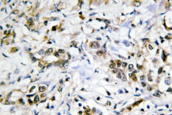 GAL4 / Galectin 4 Antibody (Lys83)