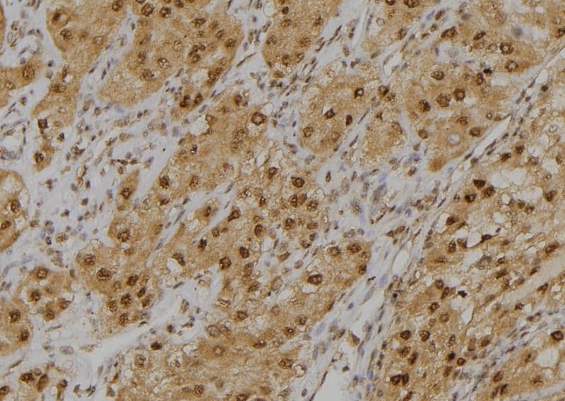 GLO1 / Glyoxalase I Antibody