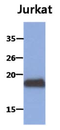 MAFK Antibody (clone AT2F7)