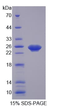 Mouse XCR1 Protein (Recombinant His, N-Terminal)