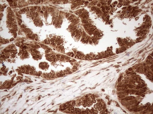 Monoclonal Mouse anti-Human ALOX5 / 5-LOX Antibody (clone OTI3F1, aa18-364, IHC, WB)