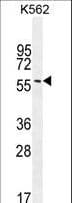 EIF2B4 Antibody (aa146-175)