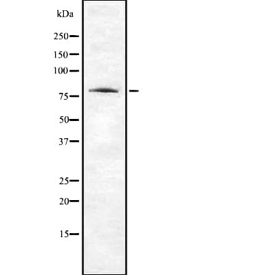 Polyclonal Rabbit anti-Human ABI2B / ABI2 Antibody (WB)