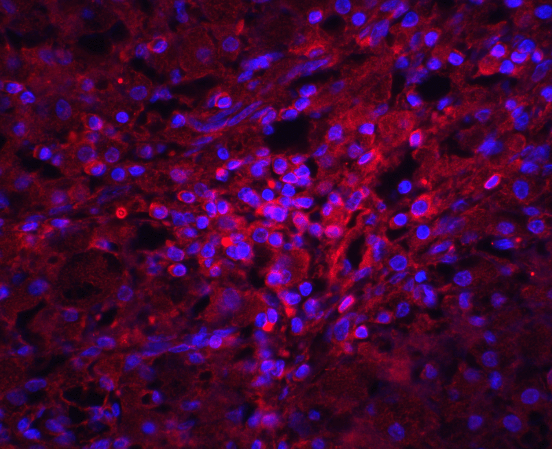 TMEM142A / ORAI1 Antibody