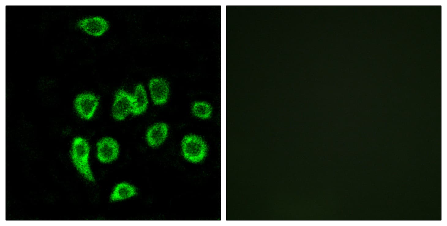 MRPL32 Antibody (aa101-150)