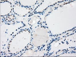 PPP5C Antibody (clone OTI5G5)
