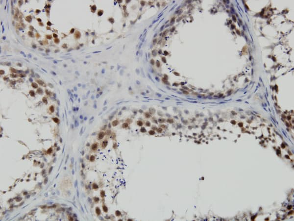 Monoclonal Mouse anti-Human PBK / TOPK Antibody (clone 3A7, IHC, IF, WB)