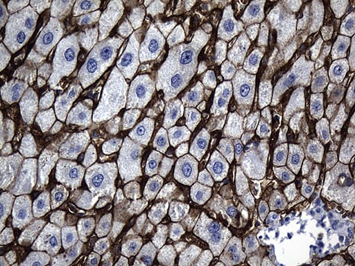 Monoclonal Mouse anti-Human SLC39A5 / ZIP5 Antibody (clone OTI2F2, aa48-178, IHC, WB)