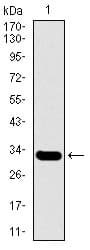 Monoclonal Mouse anti-Human SLC27A5 / BACS Antibody (clone 4B11C10, aa508-570, IHC, WB)