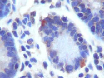 GPR49 / LGR5 Antibody (aa650-700)