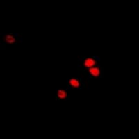 Polyclonal Rabbit anti-Human RAG2 / RAG-2 Antibody (IF, WB)