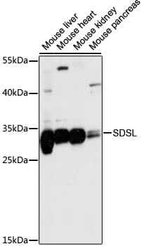 SDSL / Serine Dehydratase-Like Antibody