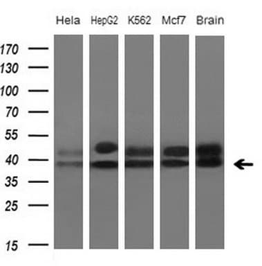 TNFRSF10B / Killer / DR5 Antibody (aa203-411, clone OTI1B9)