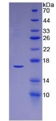 Human LGALS1 / Galectin 1 Protein (Recombinant His)