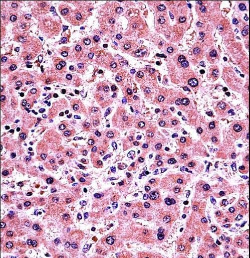 PLAP / Alkaline Phosphatase Antibody (aa282-309)