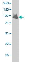 VAV1 / VAV Antibody (clone 9C1)
